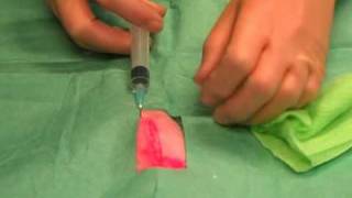 Suturing 1 Infiltrating local anaesthetic [upl. by Suzi]