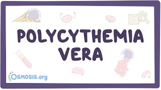 Polycythemia vera  causes symptoms diagnosis treatment pathology [upl. by Reibaj585]