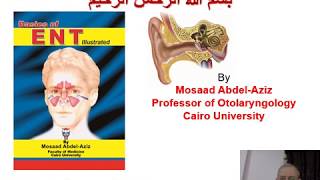 Ear 6 Mosaad AbdelAziz Trauma Tumors amp Otosclerosis [upl. by Rovit63]