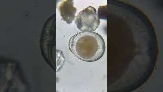 Foraminifera using its pseudopodia 😮 [upl. by Charles]