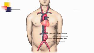 Abdominal Aortic Aneurysm انوریزم ابهر بطنی  Dr Najib Rahmani MD [upl. by Alahcim913]