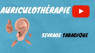 🤕👂 Auriculothérapie  l’Envie de Fumer amp Sevrage Tabagique [upl. by Rimma]