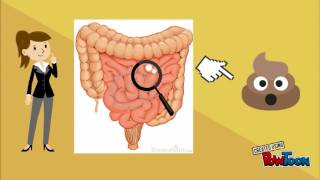 Ciclo de vida de strongyloides stercoralis [upl. by Cristal]