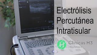 EPI en fisioterapia Electrólisis percutánea Intratisular Madrid ¿Qué es [upl. by Nema]