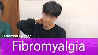 Treatment case of Fibromyalgia  섬유근육통 치료사례 [upl. by Witty]