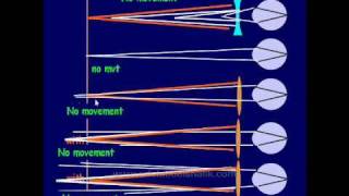 Optics  Retinoscopy Part One in Arabic [upl. by Starks]