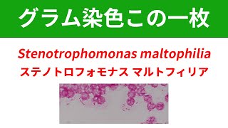 今日のグラム染色この一枚 Stenotrophomonas maltophiliaによる菌血症 [upl. by Meekah173]