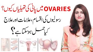 Anda Dani Ki Rasoli Ka Ilaj  Ovarian Cyst Signs And Symptoms  Dr Maryam Raana Gynaecologist [upl. by Apollo]