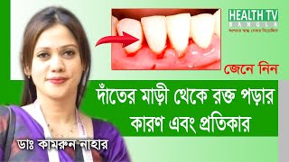 দাঁতের মাড়ি থেকে রক্ত পড়ার কারণ ও প্রতিকার  Causes and remedies for bleeding gums  DrKamrun Nahar [upl. by Alled]