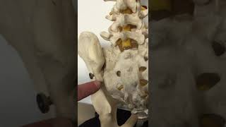 Rhizotomy of the SacroIliac Joint [upl. by Isola]