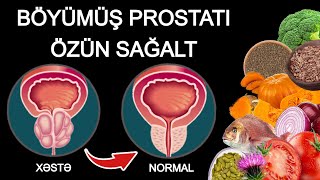 PROSTATIN EVDƏ TƏBİİ MÜALİCƏSİ  Kişilərin 90i Bunu Bilmir [upl. by Eanert]