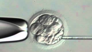 INSTITUT MARQUÈS  Embryo Fragment Removal  IVF [upl. by Leind]