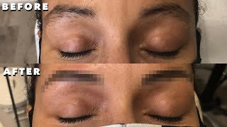 Eyebrow Microblading  Everything You Need To Know  Eyebrow Microblading QampA [upl. by Ytinav]