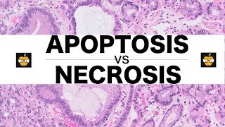 Apoptosis Intrinsic Extrinsic Pathways vs Necrosis [upl. by Glenn]