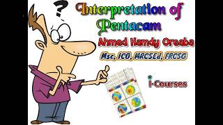 Pentacam Interpretation English [upl. by Lemmor]