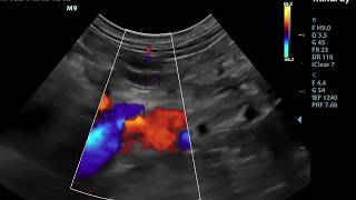 Small Animal Ultrasound  PortoSystemic Shunt  PSS [upl. by Goldia]