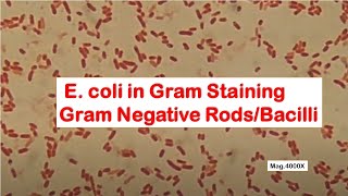 E coli in Gram Staining [upl. by Mulford]