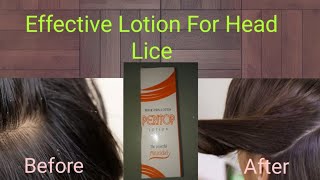 Lotion For Head LiceHair Care TipsHair RemediesTips For Head Lice [upl. by Hadihahs]