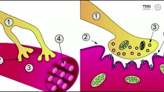 What are Trigger Points [upl. by Eelyahs]