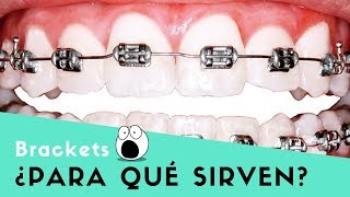 ¿Para que sirven los BRACKETS [upl. by Trub]