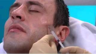 ITV Live Sculptra Treatment for Male Patient with Facial Fat Loss [upl. by Kama]