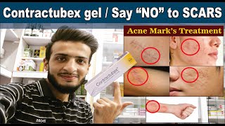 Contractubex gel  Get rid of SCARS Quickly  Uses amp Sid effects  Acne Scars Treatment  O Beauty [upl. by Enihsnus]