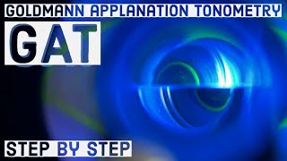 Goldmann applanation Tonometry GAT  basic STEP BY STEP GUIDE [upl. by Sira57]