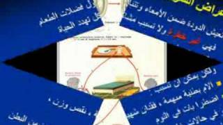 oxyuris طفيليات ديدان الحرقص  الأقصورة [upl. by Hameean]