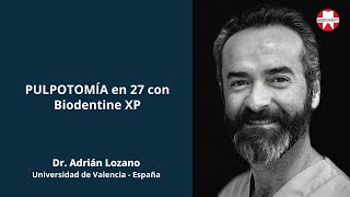 Pulpotomía con Biodentine XP  Dr Adrián Lozano [upl. by Arammat]