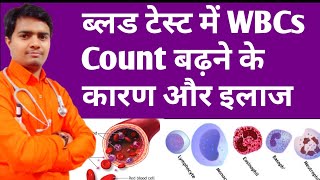 High Wbcs Count In Blood  ब्लड में WBCs बढ़ने के कारण और इलाज  High Wbc Count Treatment In Hindi [upl. by Venetis]