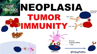 NEOPLASIA 9 TUMOR IMMUNITY tumor antigens Evasion of tumor immunity [upl. by Navonoj]