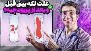 علت لکه بینی قبل و بعد از پریود چیست؟ [upl. by Beeck]