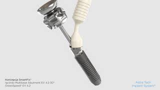 SmartFix concept Astra Tech Implant System® EV Multibase Abutment EV 30 PL [upl. by Ecidnarb]