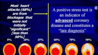 What Does Your Stress Test Really Mean  The Princeton Longevity Center [upl. by Kress]