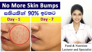 Best Treatment for Oily Skin Bumps with Scientific Explanation  Magical ResultsJust one ingredient [upl. by Llerrat80]