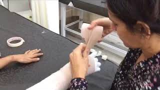 BANDAGING TECHNIQUES FOR UPPER EXTREMITY LYMPHEDEMA [upl. by Macy494]