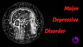 Major depressive disorder MDD  DSM5 diagnostic criteria  Symptoms [upl. by Ingmar354]