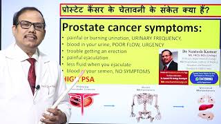 Warning Signs of Prostate Cancer  DrProfSantosh Kumar PGI [upl. by Arocahs798]