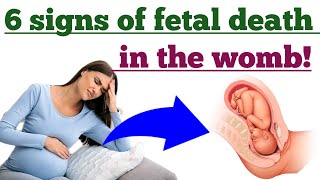 6 Signs of fetal death in the womb and How to prevent it  Stillbirth signs and prevention [upl. by Halik]