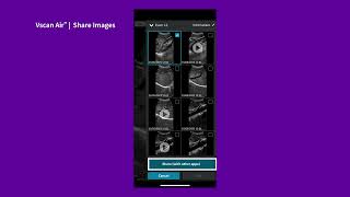 Vscan Air™ Tutorials  Share Images [upl. by Brana]