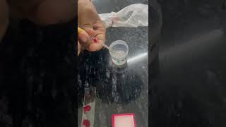 Red Blood Cell Count  Physiology Practical  MBBS  ytshorts trendingreels mbbsstudent rbc [upl. by Sinnaiy]