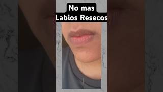 Mejor remedio para Labios Resecos  Elimina labios resecos en un dia [upl. by Reffotsirhc666]