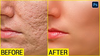 Face ko Smooth kaise kare  High  End Skin Retouching Photoshop Tutorial in Hindi  SABKE SAB [upl. by Asilehc286]