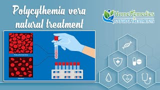 Natural treatments and home remedies for polycythemia vera [upl. by Hagood]