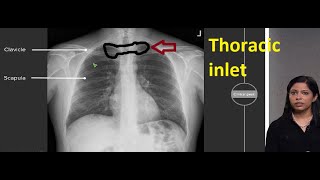 Structures passing through thoracic inlet [upl. by Retxab493]