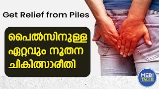 Piles latest treatment method  പൈൽസ് രോഗമുള്ളവർ നിർബന്ധമായും കാണുക  Piles Treatment Malayalam [upl. by Sherrard]