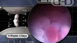 The Beating Heart in Slow Motion 4 12 Weeks Pregnant [upl. by Anoi]