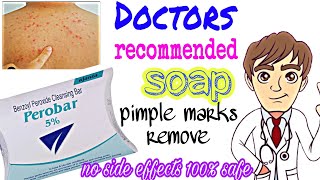 perobar 5 soap Benzoyl peroxide for acneమొటిమలు మరియు మచ్చలుపోవడానికి ఎంతగానో ఉపయోగపడే perobar🧐 [upl. by Marguerita]