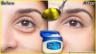 In just 3 days it removes puffy eyes eye bags completely  dark circles under eyes home remedy [upl. by Consuela]