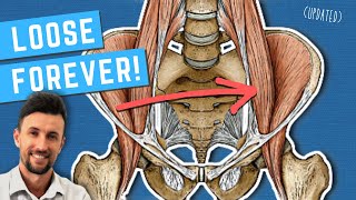 How to Permanently Loosen a Tight Psoas Updated [upl. by Wadsworth]